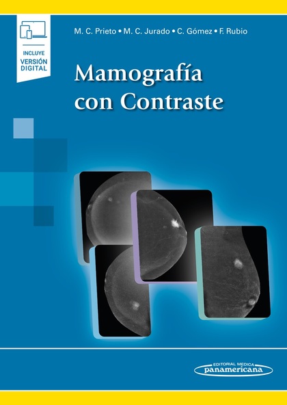 MAMOGRAFÍA CON CONTRASTE (+EBOOK)