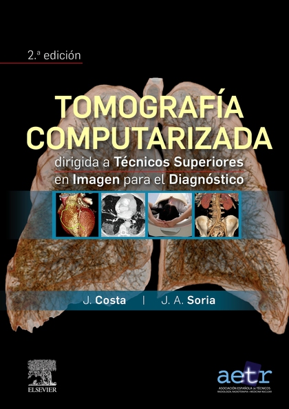 TOMOGRAFÍA COMPUTARIZADA DIRIGIDA A TÉCNICOS SUPERIORES EN IMAGEN PARA EL DIAGNÓ.