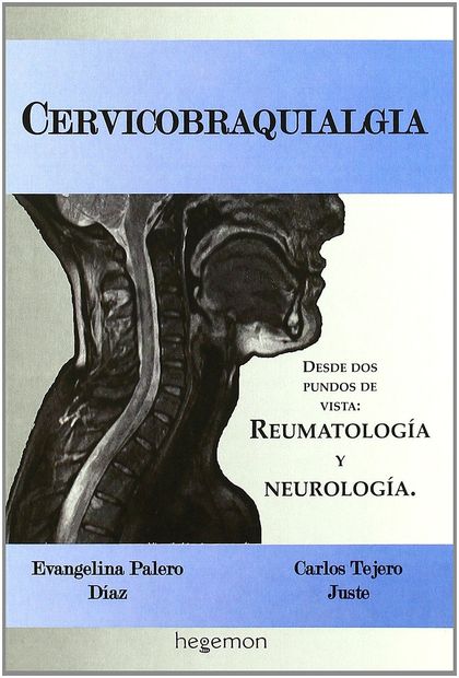CERVICOBRANQUIALGIA : DESDE DOS PUNTOS DE VISTA : REUMATOLOGÍA Y NEUROLOGÍA