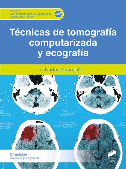 TÉCNICAS DE TOMOGRAFÍA COMPUTERIZADA (3.ª EDICIÓN REVISADA Y AMPLIADA)