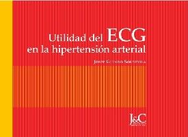 UTILIDAD CLÍNICA DEL ECG EN LA HIPERTENSIÓN ARTERIAL