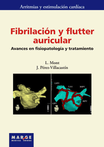FIBRILACIÓN Y FLUTTER AURICULAR