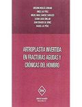 ARTOPLASTIA INVERTIDA EN FRACTURAS AGUDAS Y CRONICAS DEL HOMBRO