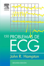150 PROBLEMAS DE ECG