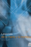LESIONES DE LA MANO Y LA MUÑECA -COLOR-.